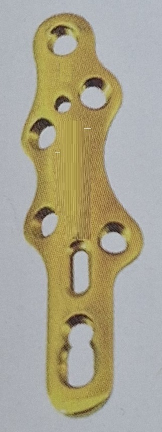 TM Bauer’s Synthes Пластина для артродезу